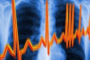 Καρδιακή ρυθμική ενάντια στην οστεοχονδρία